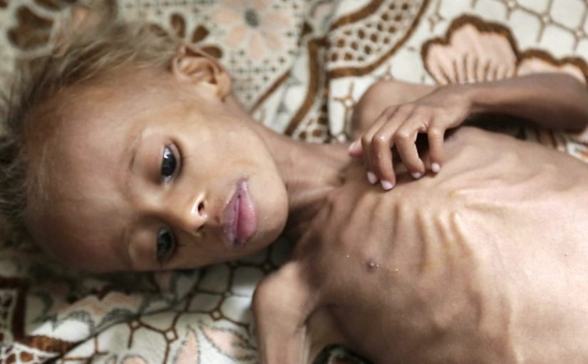 What if YOUR child was dying of starvation?